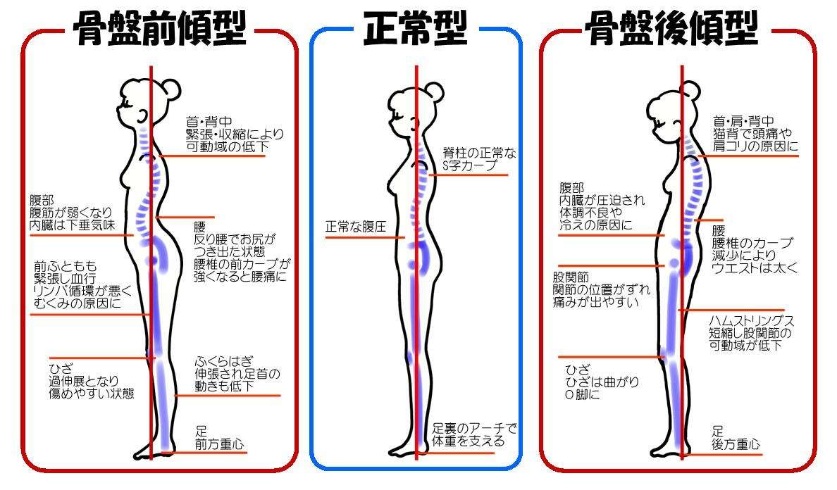 骨盤と胸椎の歪みからくるストレスや肩こりとは?