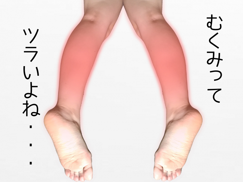 【名古屋/桜山】むくみの構造を知れば、もう悩まない
