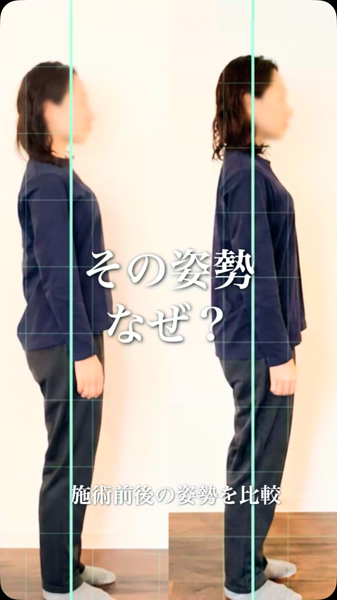 姿勢を良くしようと思った時に意識するのは、背筋を伸ばすだけで...